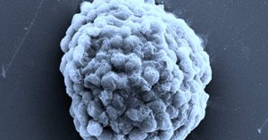 Microscopic Algae Droplets Produce Hydrogen in New Clean Energy Study